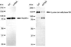 Western blotting analysis using lysine demethylase 3A antibody (ABIN7799300). (KDM3A 抗体)