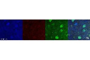 Immunohistochemistry (IHC) image for anti-Aldehyde Dehydrogenase 1 Family, Member A1 (ALDH1A1) antibody (ABIN7456135)