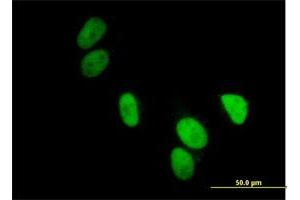 Immunofluorescence of purified MaxPab antibody to UBA2 on HeLa cell. (UBA2 抗体  (AA 1-640))