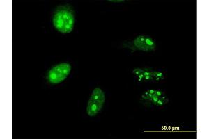 Immunofluorescence of monoclonal antibody to TP53RK on HeLa cell. (TP53RK 抗体  (AA 154-253))
