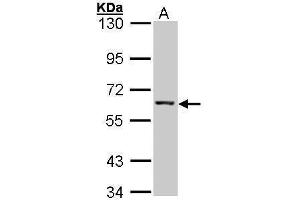WB Image Sample (30 ug of whole cell lysate) A: Hep G2 , 7. (IMPDH2 抗体)