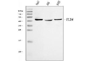 Western blot analysis of IL34 using anti-IL34 antibody (ABIN7600622).