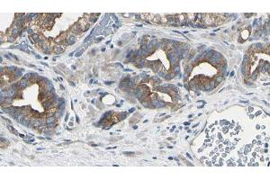 ABIN6279781 at 1/100 staining Human prostate tissue by IHC-P. (RPL22/L1 抗体)
