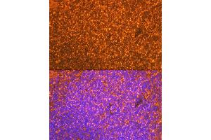 Immunofluorescence analysis of mouse spleen cells using EBI3 Rabbit mAb (ABIN7268011) at dilution of 1:100 (40x lens). (EBI3 抗体)
