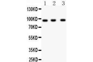 Western Blotting (WB) image for anti-Neural Precursor Cell Expressed, Developmentally Down-Regulated 9 (NEDD9) (AA 273-421) antibody (ABIN3043271) (NEDD9 抗体  (AA 273-421))