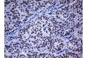 Image no. 3 for anti-Nibrin (NBN) (AA 183-460) antibody (ABIN1491067) (Nibrin 抗体  (AA 183-460))