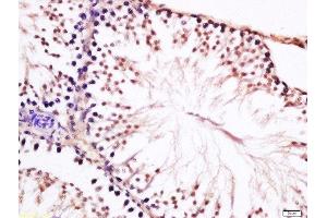 Formalin-fixed and paraffin embedded rat testis labeled with Anti-CT45A Polyclonal Antibody, Unconjugated  at 1:200 followed by conjugation to the secondary antibody and DAB staining (CT45A1 抗体  (AA 21-120))