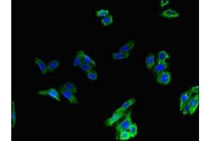 Immunofluorescent analysis of HepG2 cells using ABIN7153869 at dilution of 1:100 and Alexa Fluor 488-congugated AffiniPure Goat Anti-Rabbit IgG(H+L) (Glucagon Receptor 抗体  (AA 26-136))