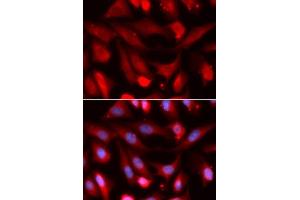 Immunofluorescence analysis of U2OS cells using SMAD4 antibody. (SMAD4 抗体  (AA 160-450))