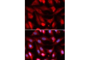 Immunofluorescence analysis of U2OS cells using SMAD4 antibody. (SMAD4 抗体  (AA 160-450))
