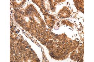 Immunohistochemistry (IHC) image for anti-Chemokine (C-C Motif) Ligand 17 (CCL17) antibody (ABIN1679017) (CCL17 抗体)