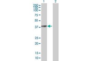 Western Blot analysis of PARK2 expression in transfected 293T cell line by PARK2 MaxPab polyclonal antibody. (Parkin 抗体  (AA 1-387))