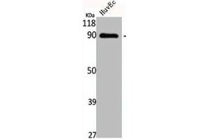 Western Blot analysis of HuvEc cells using Cadherin-16 Polyclonal Antibody (Cadherin-16 抗体  (C-Term))