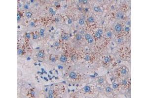IHC-P analysis of liver tissue, with DAB staining. (HADH 抗体  (AA 1-236))