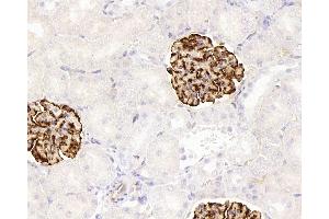 Immunohistochemistry analysis of paraffin-embedded rat kidney using NES Monoclonal Antibody at dilution of 1:400. (Nestin 抗体)