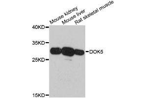 Western blot analysis of extracts of various cell lines, using DOK5 antibody. (DOK5 抗体)