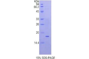 SDS-PAGE of Protein Standard from the Kit (Highly purified E. (QSOX1 ELISA 试剂盒)