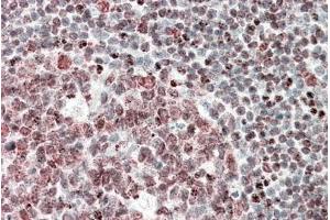 ABIN5539722 (5µg/ml) staining of paraffin embedded Human Tonsil. (FUBP1 抗体  (AA 160-174))