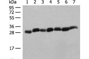 Western blot analysis of Hela cell Mouse spleen tissue Mouse liver tissue PC3 cell HL60 cell A549 cell NIH/3T3 cell lysates using PSMA3 Polyclonal Antibody at dilution of 1:350 (PSMA3 抗体)