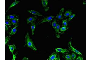 Immunofluorescent analysis of Hela cells using ABIN7159774 at dilution of 1:100 and Alexa Fluor 488-congugated AffiniPure Goat Anti-Rabbit IgG(H+L) (MAP1LC3B2 抗体  (AA 1-47))