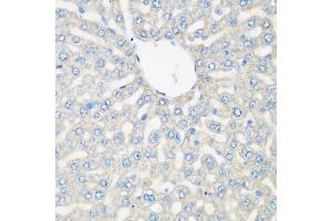 Immunohistochemistry of paraffin-embedded rat liver using C3 antibody (ABIN5975433) at dilution of 1/200 (40x lens). (C3 抗体)