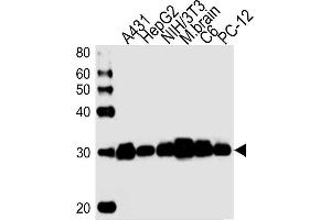 Lane 1: A431 Cell lysates, Lane 2: HepG2 Cell lysates, Lane 3: NIH/3T3 Cell lysates, Lane 4: mouse brain lysates, Lane 5: C6 Cell lysates, Lane 6: PC-12 Cell lysates, probed with YWHAZ (1314CT423. (14-3-3 zeta 抗体)