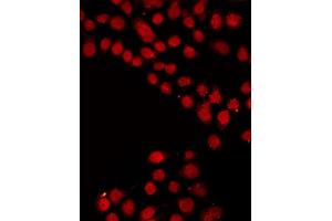 ABIN6267372 staining LOVO by IF/ICC. (SRF 抗体  (pSer99))
