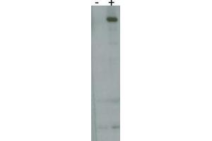 RK8 (LRRK2) Antibody  h detect over-expressed human LRRK2 protein. (LRRK2 抗体  (AA 930-961))