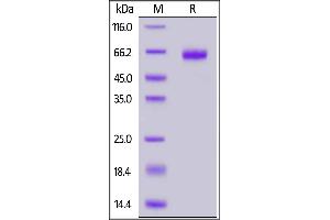 Human EpCAM, Mouse IgG2a Fc Tag on  under reducing (R) condition.