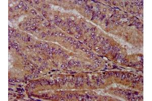 Immunohistochemistry (IHC) image for anti-Protein Phosphatase 2A Activator, Regulatory Subunit 4 (PPP2R4) (AA 1-250) antibody (ABIN7169262)
