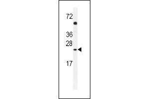 GOLGA2L1 Antibody (C-term) (ABIN654533 and ABIN2844251) western blot analysis in A549 cell line lysates (35 μg/lane). (GOLGA2P5 抗体  (C-Term))
