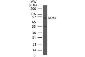 Image no. 2 for anti-Dachshund 1 (DACH1) (AA 474-491) antibody (ABIN960126) (DACH1 抗体  (AA 474-491))
