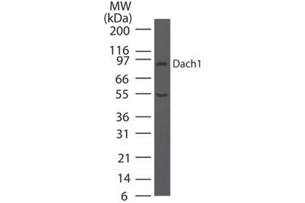 DACH1 抗体  (AA 474-491)