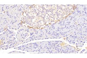 Immunohistochemistry (IHC) image for anti-Coagulation Factor III (thromboplastin, Tissue Factor) (F3) (AA 30-252) antibody (ABIN7431905)
