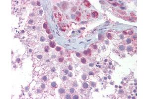 Anti-SYCP3 antibody IHC of human testis. (SYCP3 抗体  (N-Term))