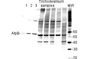 Western Blotting (WB) image for anti-ATPase, Na+/K+ Transporting, beta 1 Polypeptide (ATP1B1) (Subunit beta) antibody (ABIN93533)