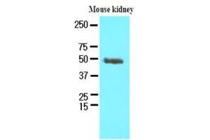 Western Blotting (WB) image for anti-Proteasome (Prosome, Macropain) 26S Subunit, Non-ATPase, 11 (PSMD11) (AA 1-422), (N-Term) antibody (ABIN371887) (PSMD11 抗体  (N-Term))