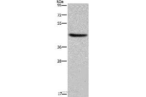 Western blot analysis of Human adrenal gland tissue, using HSD3B1 Polyclonal Antibody at dilution of 1:250 (HSD3B1 抗体)