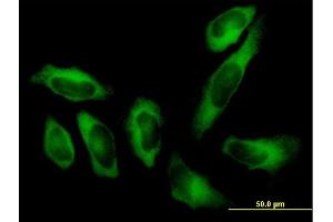 Immunofluorescence of purified MaxPab antibody to AARS on HeLa cell. (AARS 抗体  (AA 1-968))