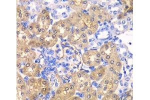 Immunohistochemistry of paraffin-embedded Rat kidney using HPD Polyclonal Antibody at dilution of 1:100 (40x lens). (HPD 抗体)