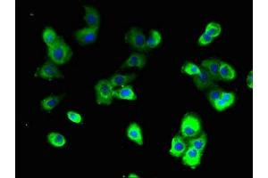 Immunofluorescent analysis of A431 cells using ABIN7175216 at dilution of 1:100 and Alexa Fluor 488-congugated AffiniPure Goat Anti-Rabbit IgG(H+L) (ATP6VA2 (AA 476-549), (Isoform 2) 抗体)