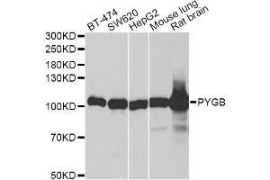 Western blot analysis of extracts of various cell lines, using PYGB antibody (ABIN6293330) at 1:1000 dilution. (PYGB 抗体)