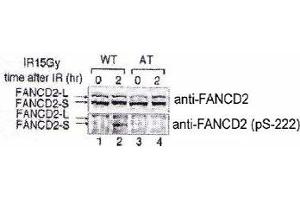 Indicated lymphoblasts (PD7, WT : GM1526, AT) were irradiated with 15 Gy (2), and immunoblotted with anti-FANCD2 and FANCD2 (phospho S222) polyclonal antibody . (FANCD2 抗体  (pSer222))