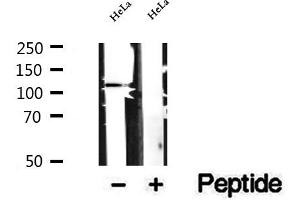 Western blot analysis of extracts of HeLa cells, using DAAM1 antibody. (DAAM1 抗体  (Internal Region))