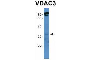 Host:  Rabbit  Target Name:  VDAC3  Sample Type:  RPMI-8226  Antibody Dilution:  1. (VDAC3 抗体  (N-Term))