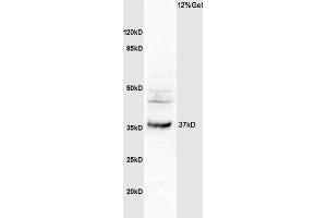 L1 human colon carcinoma lysates probed with Anti OSTM1 Polyclonal Antibody, Unconjugated (ABIN1387308) at 1:200 overnight at 4 °C. (OSTM1 抗体  (AA 21-120))