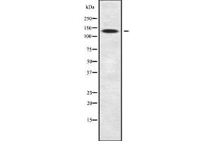 Western blot analysis SLC9A11 using COS7 whole cell lysates (SLC9C2/SLC9A11 抗体)