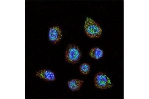 Confocal immunofluorescent analysis of HIF-1 alpha antibody with MDA-MB231 cells followed by Alexa Fluor 488-conjugated goat anti-rabbit lgG (green). (HIF1A 抗体  (AA 728-757))