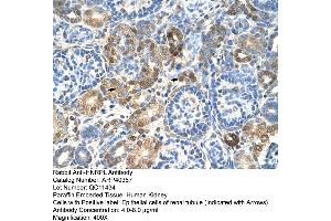 Rabbit Anti-HNRPL Antibody  Paraffin Embedded Tissue: Human Kidney Cellular Data: Epithelial cells of renal tubule Antibody Concentration: 4. (HNRNPL 抗体  (N-Term))