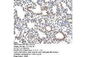 Human Lung (ZNF195 抗体  (N-Term))
